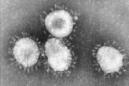 Imagen de archivo en blanco y negro del coronavirus al microscopio. EFE