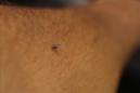 Fotografía de un mosquito en el brazo de una persona en el estado mexicano de Tabasco. EFE/Archivo